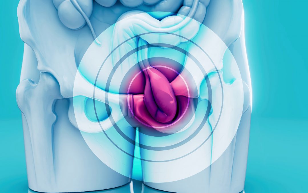 La importancia de detectar oportunamente el Cáncer de Vejiga
