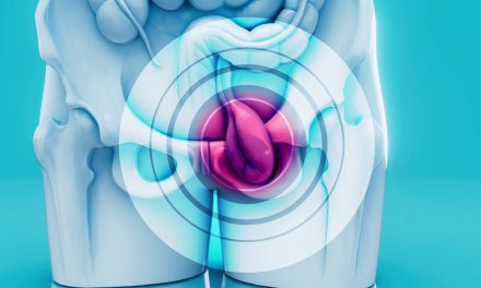 La importancia de detectar oportunamente el Cáncer de Vejiga