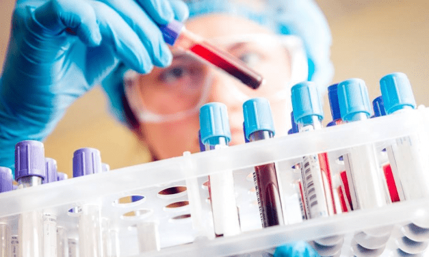 Análisis de sangre muestra potencial para detectar cáncer testicular cuando los marcadores estándar no lo detectan
