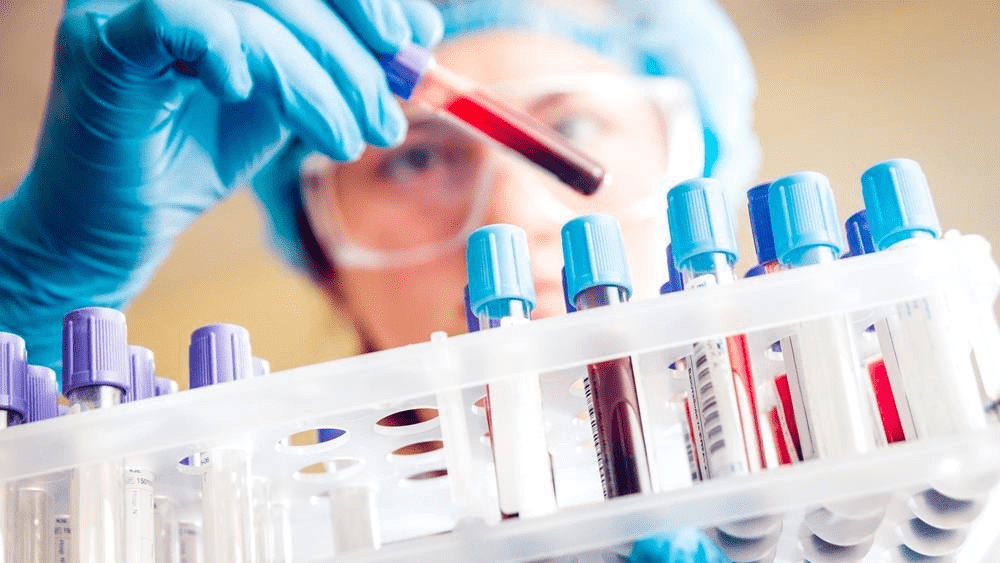 Análisis de sangre muestra potencial para detectar cáncer testicular cuando los marcadores estándar no lo detectan