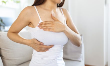 Cáncer de mama inflamatorio: Una forma de rápida evolución que a menudo no presenta un bulto como señal de alarma